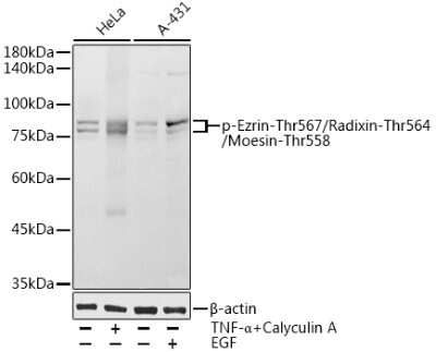 Western Blot: Ezrin/Radixin/Moesin [p Thr567, p Thr564, p Thr558] AntibodyAzide and BSA Free [NBP3-16959]